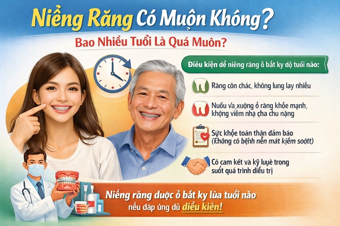 Các bước chuẩn bị cần thiết như kiểm tra nướu, điều trị sâu răng, tuân thủ lịch tái khám và sử dụng chỉ nha khoa, tăm nước để đạt hiệu quả tốt nhất.
