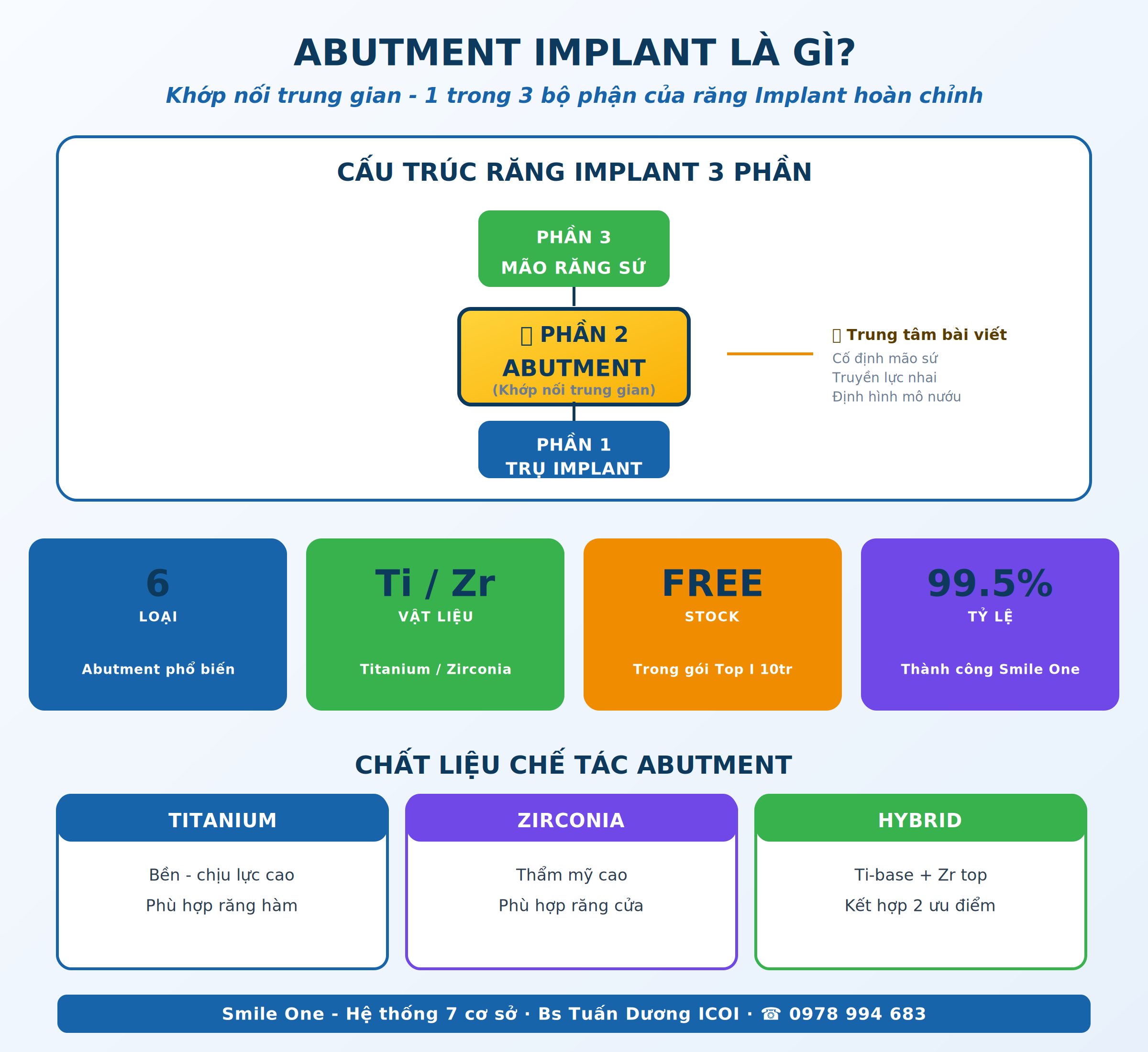 Abutment Implant là gì - khớp nối trung gian giữa trụ implant và mão răng sứ