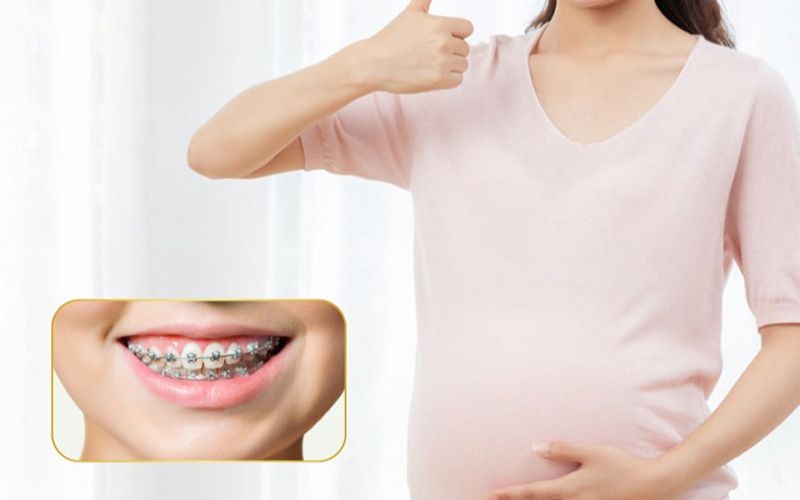 Niềng răng khi mang thai ảnh hưởng đến sức khỏe mẹ và bé