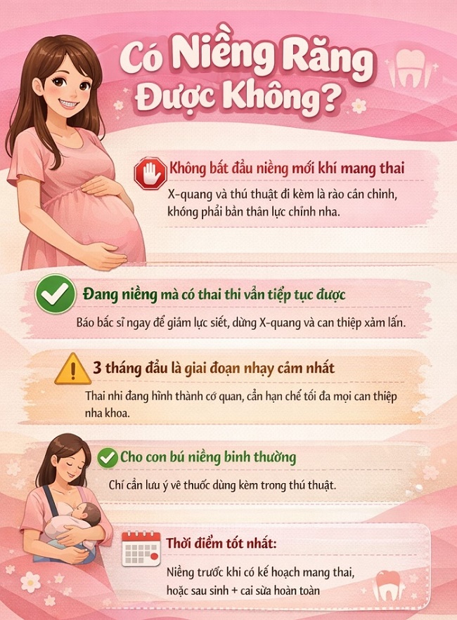 Có bầu niềng răng được không: không nên bắt đầu niềng mới nhưng có thể tiếp tục nếu đang điều trị