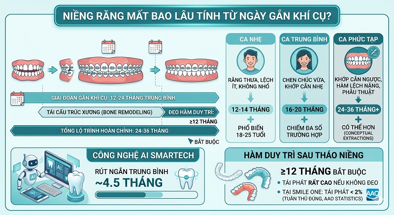 Bảng thời gian niềng răng theo tình trạng: Ca nhẹ (12-14 tháng), ca trung bình (16-20 tháng) và ca phức tạp (24-36 tháng). Lưu ý bắt buộc đeo hàm duy trì sau khi tháo niềng.