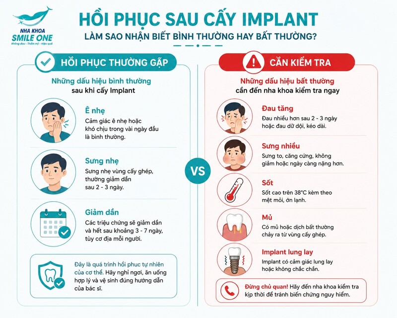 bên trái cấy một trụ Implant với lượng xương đầy đủ; bên phải vùng xương thiếu cần ghép xương trước hoặc đồng thời đặt Implant. Minh họa giải phẫu y khoa chân thực, sạch.