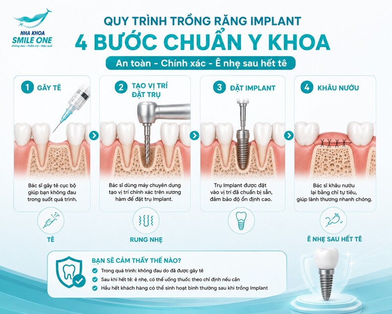 Các bước cấy ghép Implant từ gây tê đến đặt trụ vào xương hàm