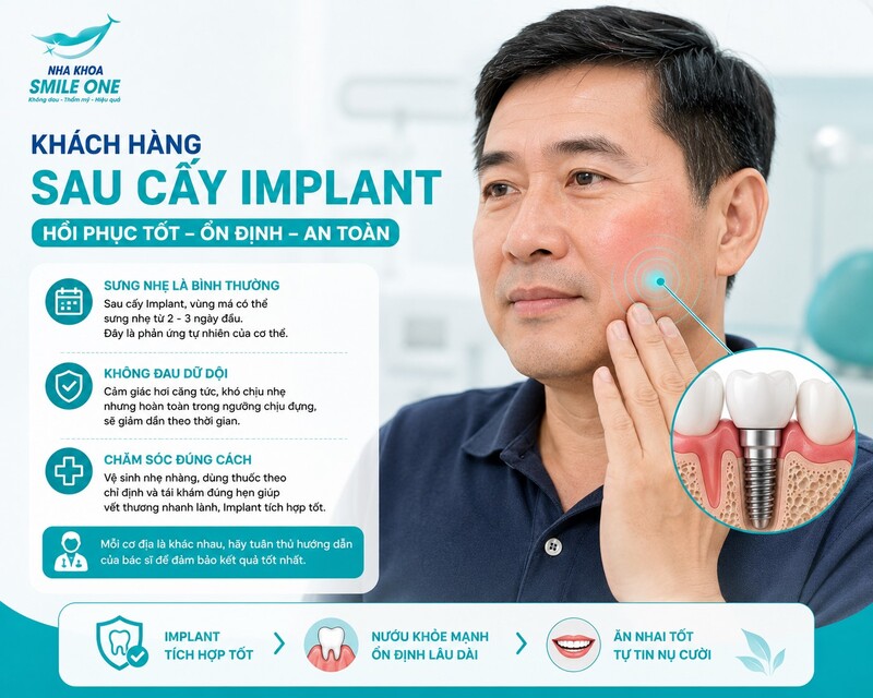 Khách hàng nam trung niên sau cấy Implant, hơi chạm tay vào vùng má có sưng nhẹ, biểu cảm bình thường, không đau dữ dội. Có thể minh họa thêm vùng Implant bên trong bằng cutaway nhỏ.