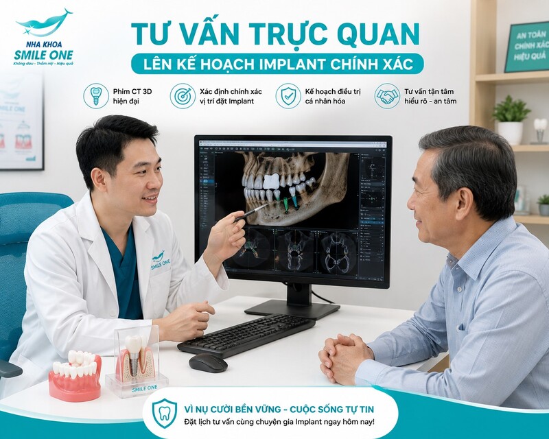 Bác sĩ nha khoa ngồi tư vấn cho khách nam khoảng 55–60 tuổi, trên màn hình hiển thị phim CT 3D vùng răng hàm và vị trí dự kiến đặt Implant. Khách lắng nghe, tâm lý thoải mái.