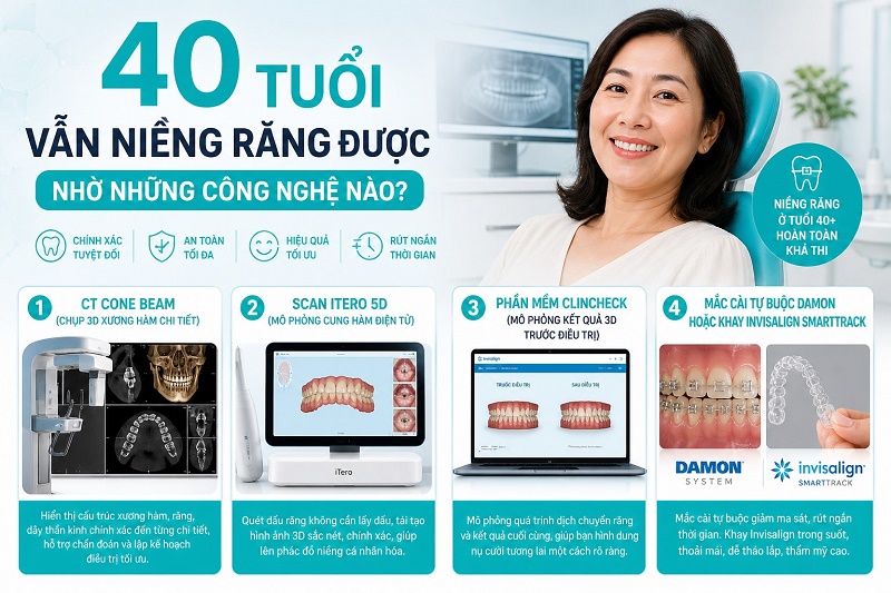 Người 40 tuổi vẫn niềng răng được nhờ 4 công nghệ chẩn đoán và điều trị hiện đại: CT Cone Beam (chụp 3D xương hàm chi tiết), scan iTero 5D (mô phỏng cung hàm điện tử),