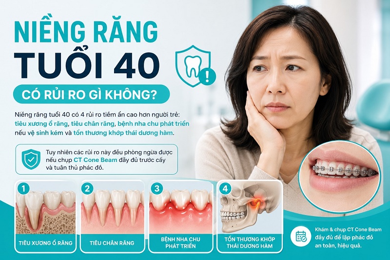 Niềng răng tuổi 40 có 4 rủi ro tiềm ẩn cao hơn người trẻ: tiêu xương ổ răng, tiêu chân răng, bệnh nha chu phát triển nếu vệ sinh kém và tổn thương khớp thái dương hàm.
