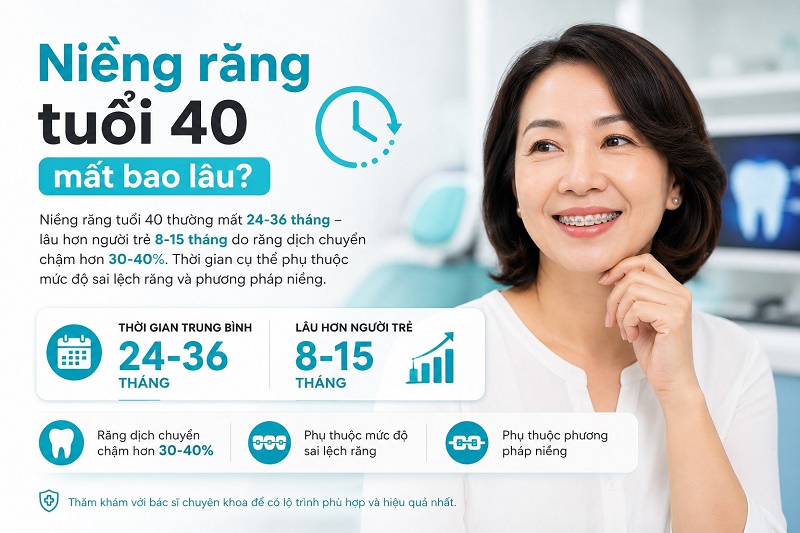 Niềng răng tuổi 40 thường mất 24-36 tháng - lâu hơn người trẻ 8-15 tháng