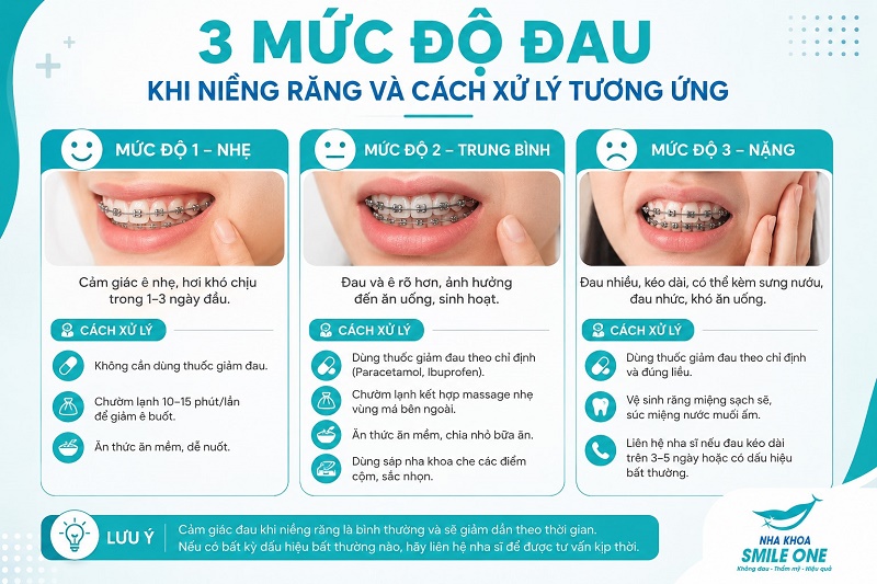 Vì sao niềng răng bị đau? 3 thời điểm đau nhất