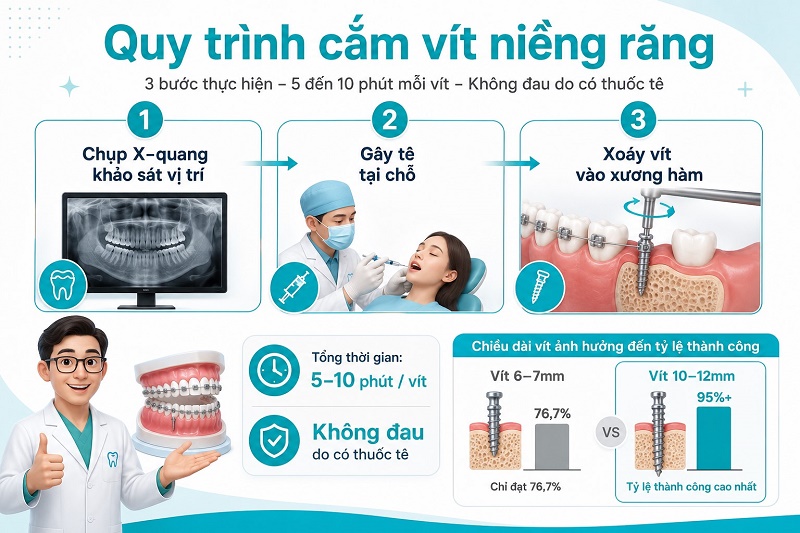 Quy trình cắm vít niềng răng gồm 3 bước: chụp X-quang khảo sát vị trí - gây tê tại chỗ - xoáy vít vào xương hàm.