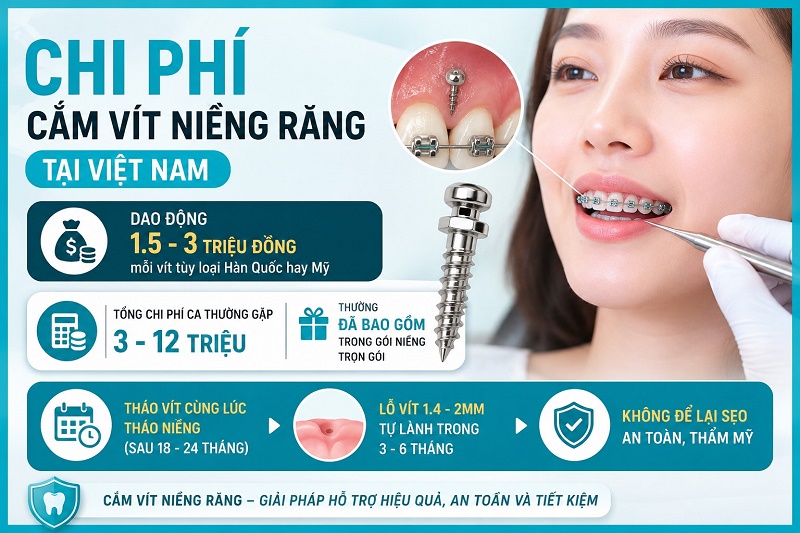 Chi phí cắm vít niềng răng tại Việt Nam dao động 1.5-3 triệu đồng mỗi vít tùy loại Hàn Quốc hay Mỹ.