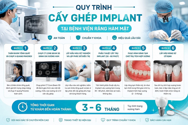 Quy trình cấy ghép implant tại bệnh viện răng hàm mặt gồm 6 bước chuẩn