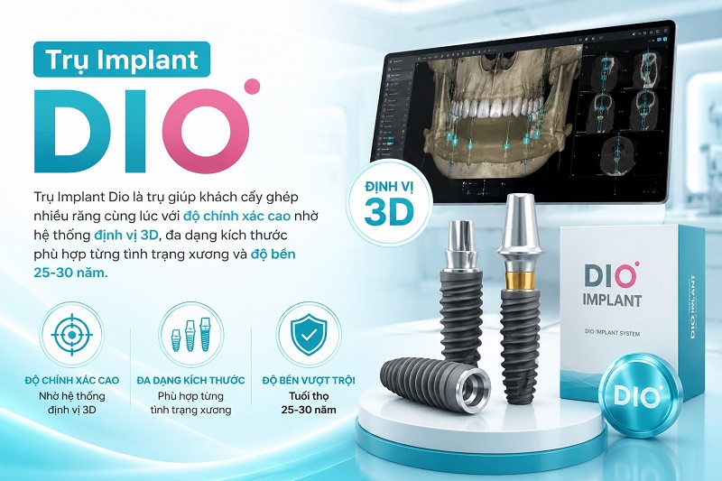 Cách chọn loại trụ implant phù hợp