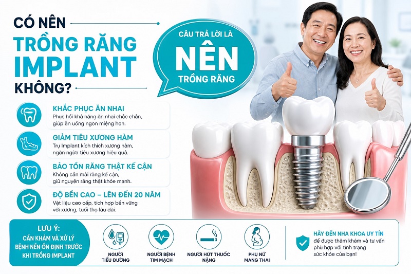 Có nên trồng răng implant không