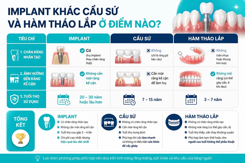 Nhược điểm cần cân nhắc khi trồng implant