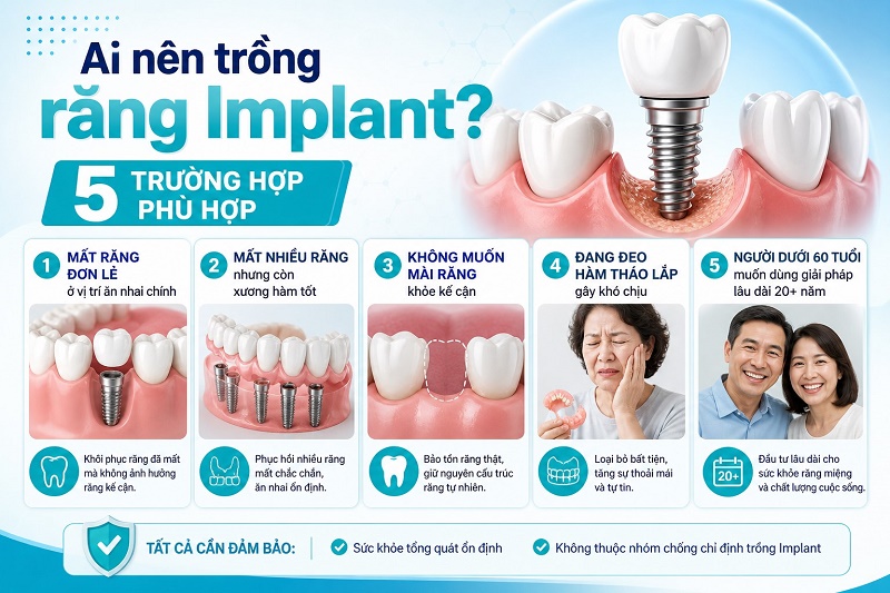 Những ai không nên trồng implant