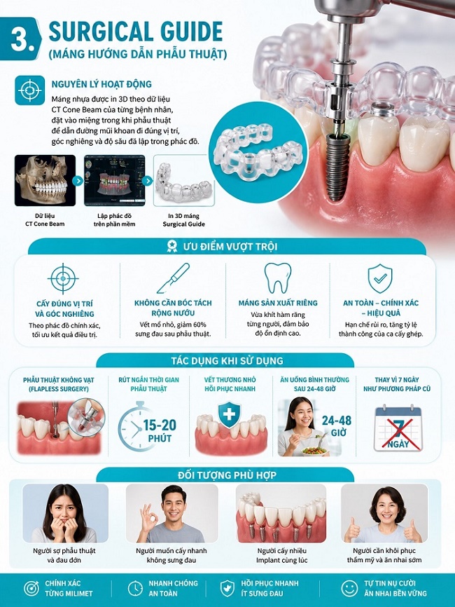 Surgical Guide (máng hướng dẫn phẫu thuật)