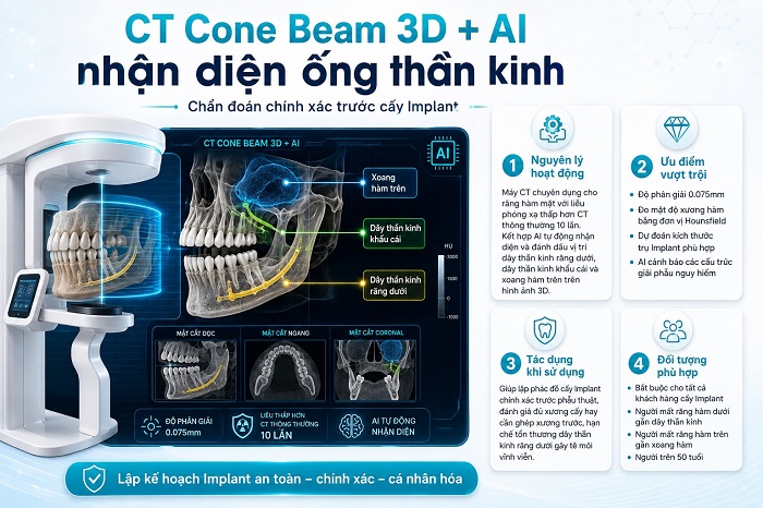 CT Cone Beam 3D + AI nhận diện ống thần kinh