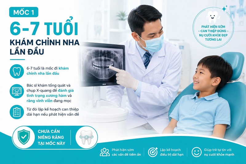 Vì sao 12-16 tuổi là thời điểm vàng niềng răng