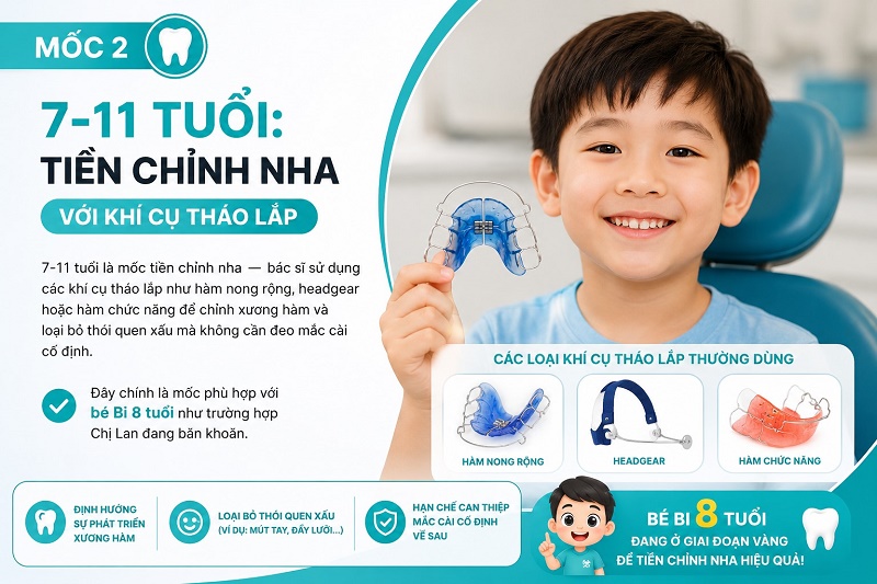 Các giai đoạn niềng răng cho con theo độ tuổi