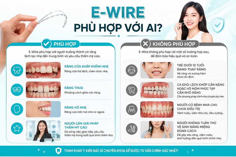 E-Wire phù hợp với người trưởng thành có răng lệch lạc nhẹ đến trung bình như răng cửa khấp khểnh nhẹ,