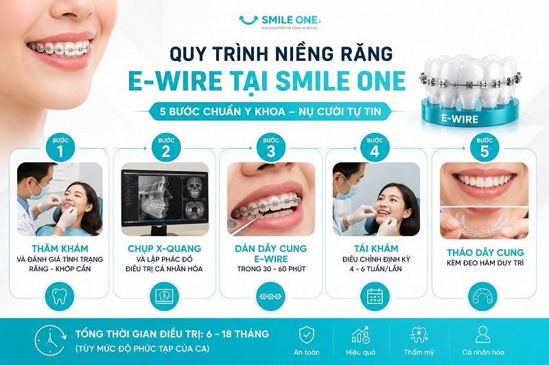 Quy trình niềng răng E-Wire tại Smile One gồm 5 bước: thăm khám và đánh giá tình trạng răng-khớp cắn