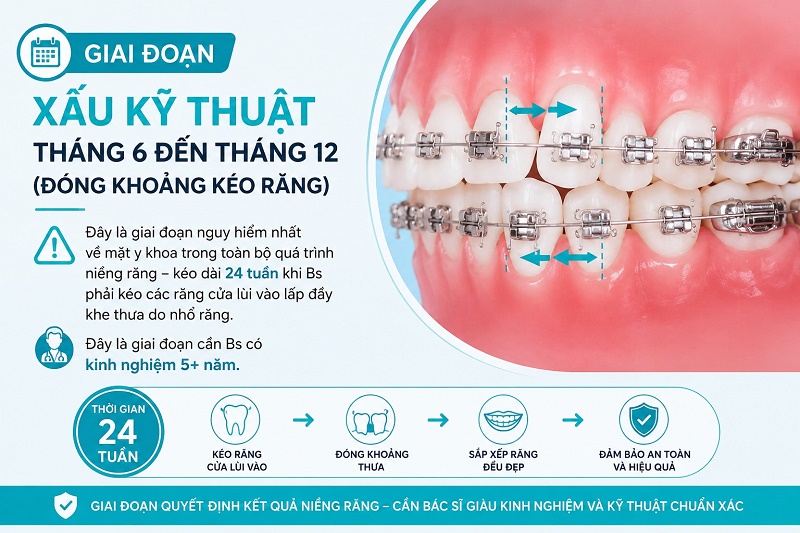 Đây là giai đoạn nguy hiểm nhất về mặt y khoa trong toàn bộ quá trình niềng răng