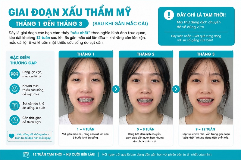 Giai đoạn xấu thẩm mỹ — Tháng 1 đến tháng 3