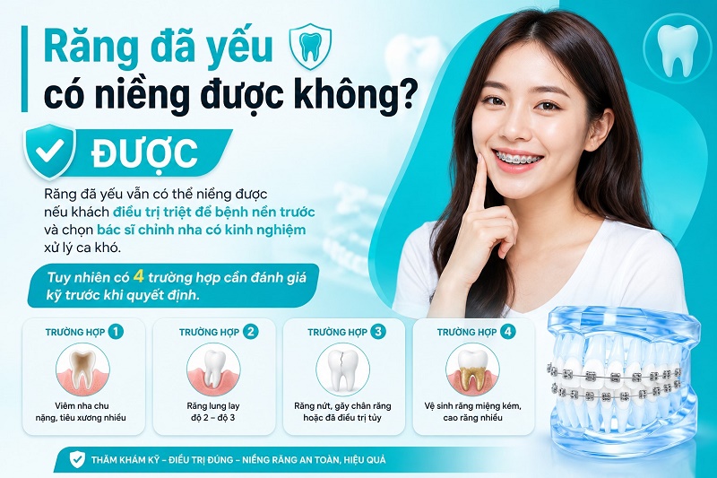 ĐƯỢC - Răng đã yếu vẫn có thể niềng được nếu khách điều trị triệt để bệnh nền