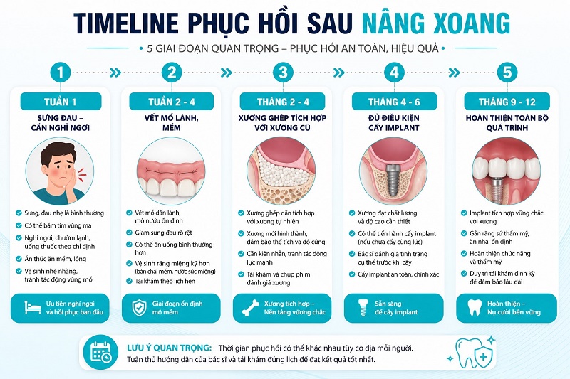 Timeline phục hồi sau nâng xoang chia 5 giai đoạn rõ ràng từ tuần đầu đến tháng thứ 12