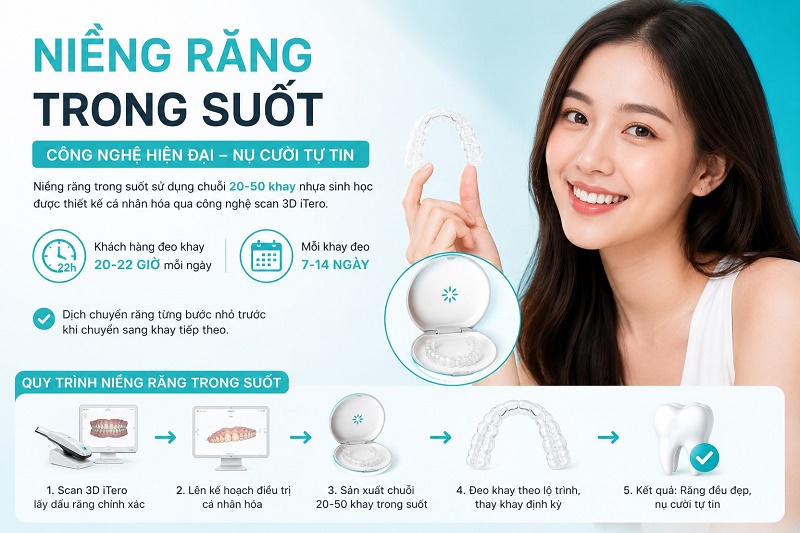 Niềng răng trong suốt và mắc cài mất bao lâu
