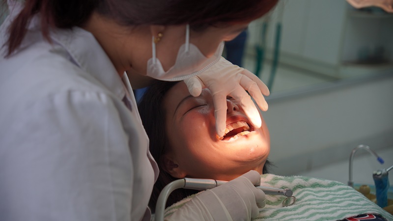 Đặc trưng phong cách bọc răng sứ của Bác sĩ Dương: