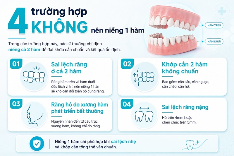 Quá trình niềng răng 1 hàm kéo dài bao lâu