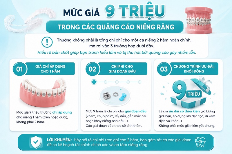 Mức giá 9 triệu trong các quảng cáo niềng răng thường không phải là tổng chi phí