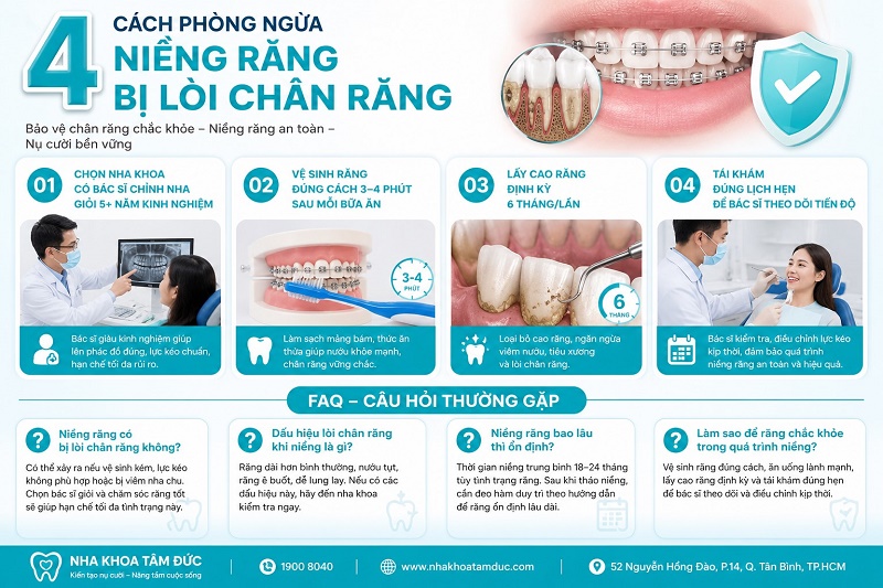 4 cách phòng ngừa niềng răng bị lòi chân răng gồm: chọn nha khoa có bác sĩ chỉnh nha giỏi 5 năm kinh nghiệm