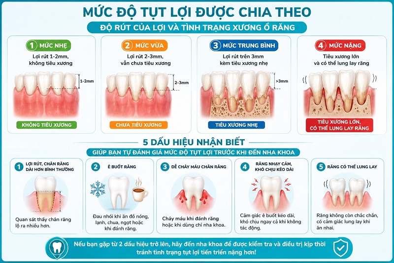 mức độ tụt lợi được chia theo độ rút của lợi và tình trạng xương ổ răng: