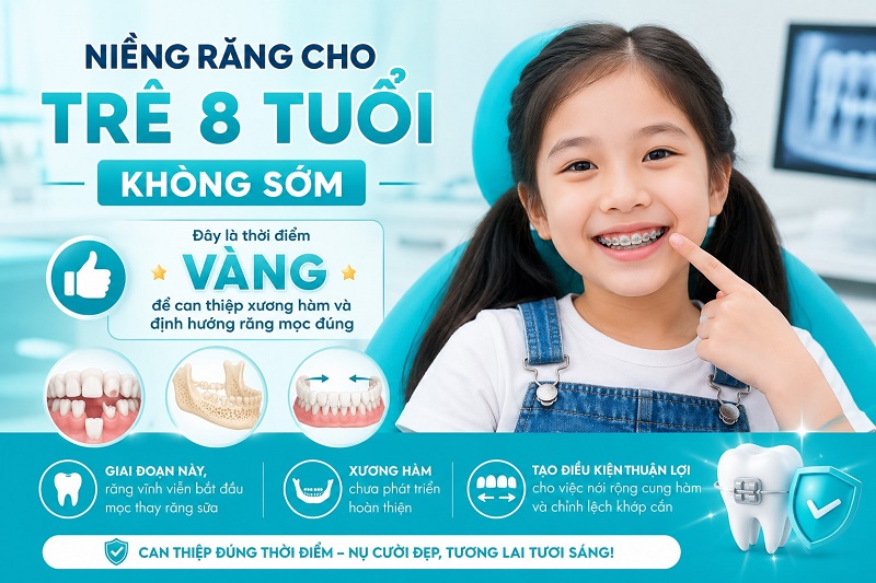 Niềng răng cho trẻ 8 tuổi KHÔNG sớm — đây là thời điểm vàng để can thiệp xương hàm và định hướng răng mọc đúng.