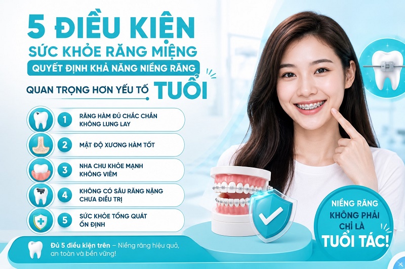 5 điều kiện sức khỏe răng miệng quyết định khả năng niềng răng quan trọng hơn yếu tố TUỔI gồm