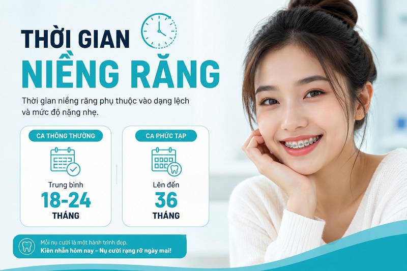 Thời gian niềng răng phụ thuộc vào dạng lệch và mức độ nặng nhẹ.