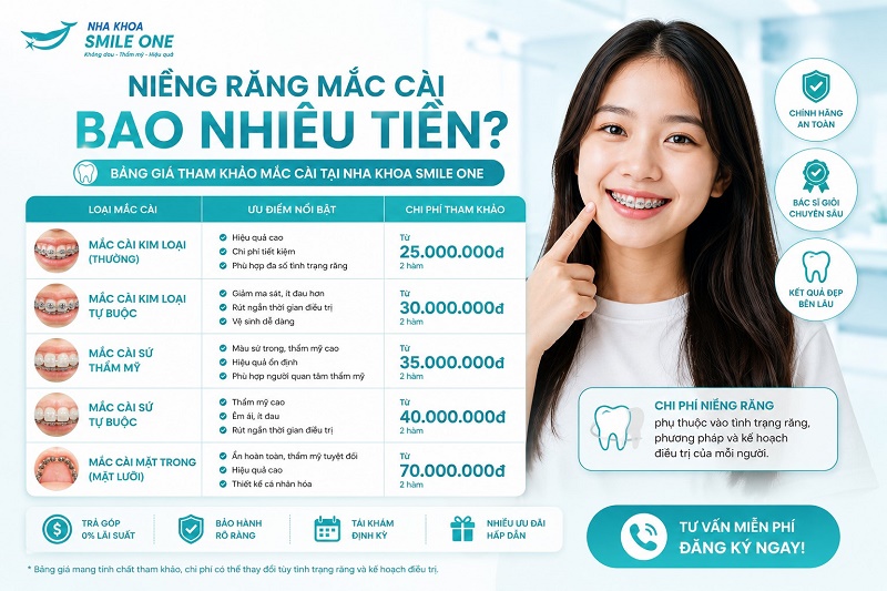 Bảng giá niềng răng mắc cài chi tiết