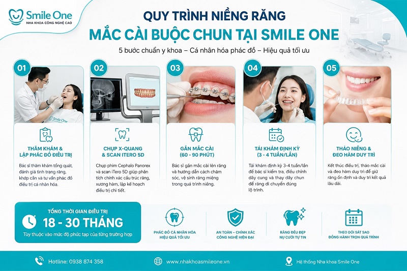 Quy trình niềng răng mắc cài buộc chun tại Smile One gồm 5 bước chuẩn: thăm khám và lập phác đồ điều trị,