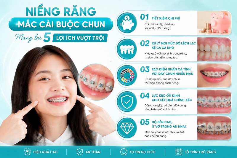 Niềng răng mắc cài buộc chun mang lại 5 lợi ích cụ thể cho khách hàng: tiết kiệm chi phí