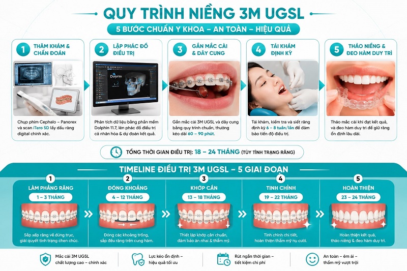 Quy trình niềng răng mắc cài 3M UGSL gồm 5 bước: thăm khám chụp phim Cephalo-Panorex
