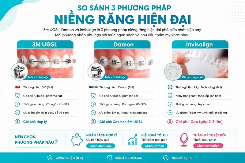 3M UGSL, Damon và Invisalign là 3 phương pháp niềng răng hiện đại phổ biến nhất hiện nay
