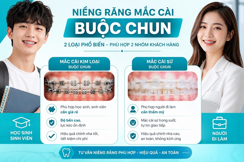 Niềng răng mắc cài buộc chun có 2 loại phổ biến phù hợp với 2 nhóm khách hàng khác nhau