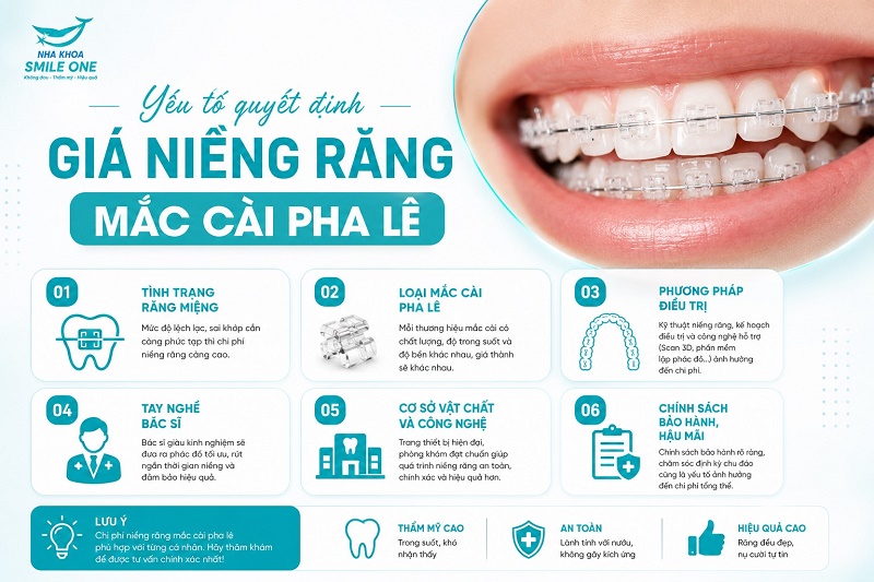 yếu tố quyết định giá niềng răng mắc cài pha lê