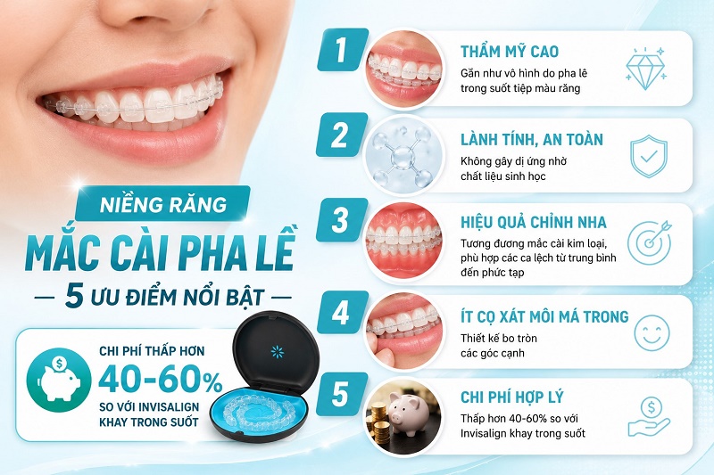 Niềng răng mắc cài pha lê có 5 ưu điểm nổi bật: thẩm mỹ cao gần như vô hình do pha lê trong suốt tiệp màu răng,