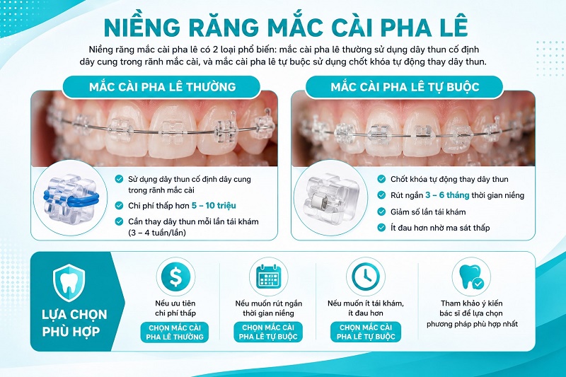Niềng răng mắc cài pha lê có 2 loại phổ biến: mắc cài pha lê thường sử dụng dây thun cố định dây