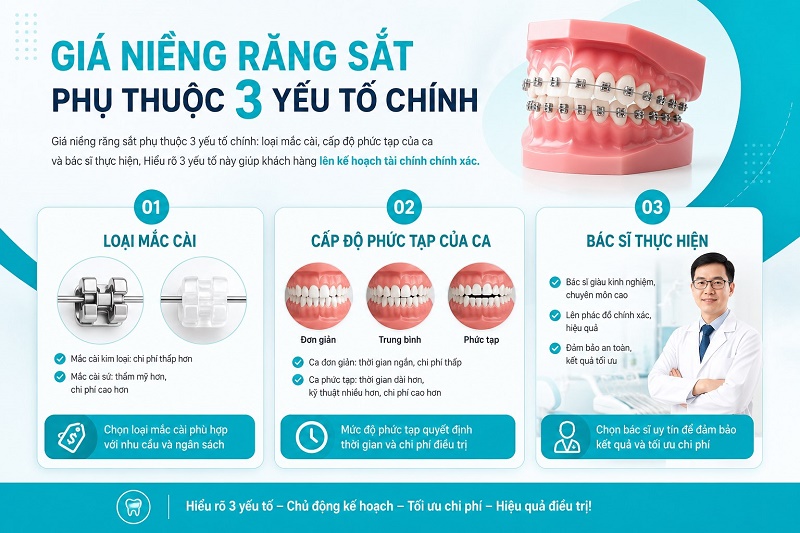 Yếu tố ảnh hưởng giá niềng răng sắt