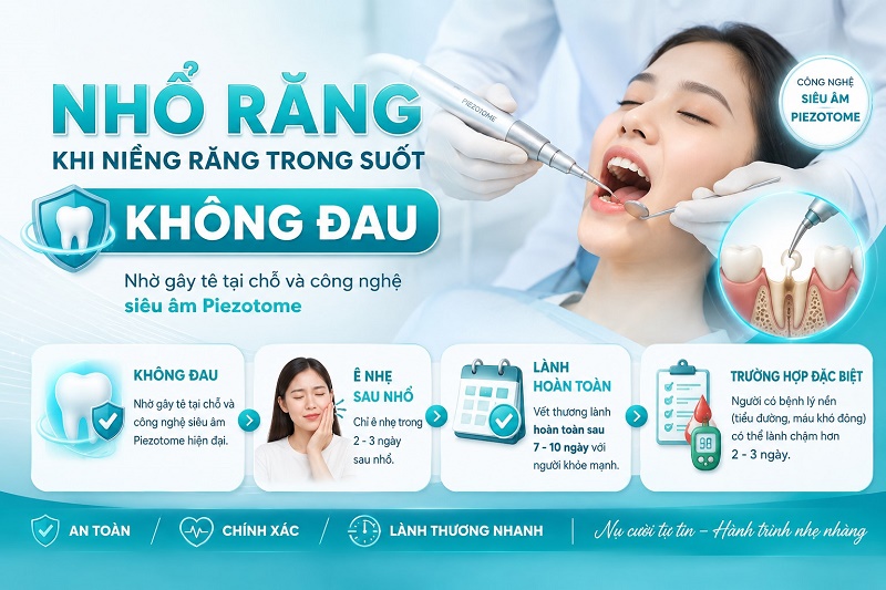 Cách hạn chế và thay thế nhổ răng khi niềng trong suốt